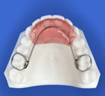 positioner