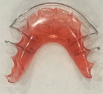retainers